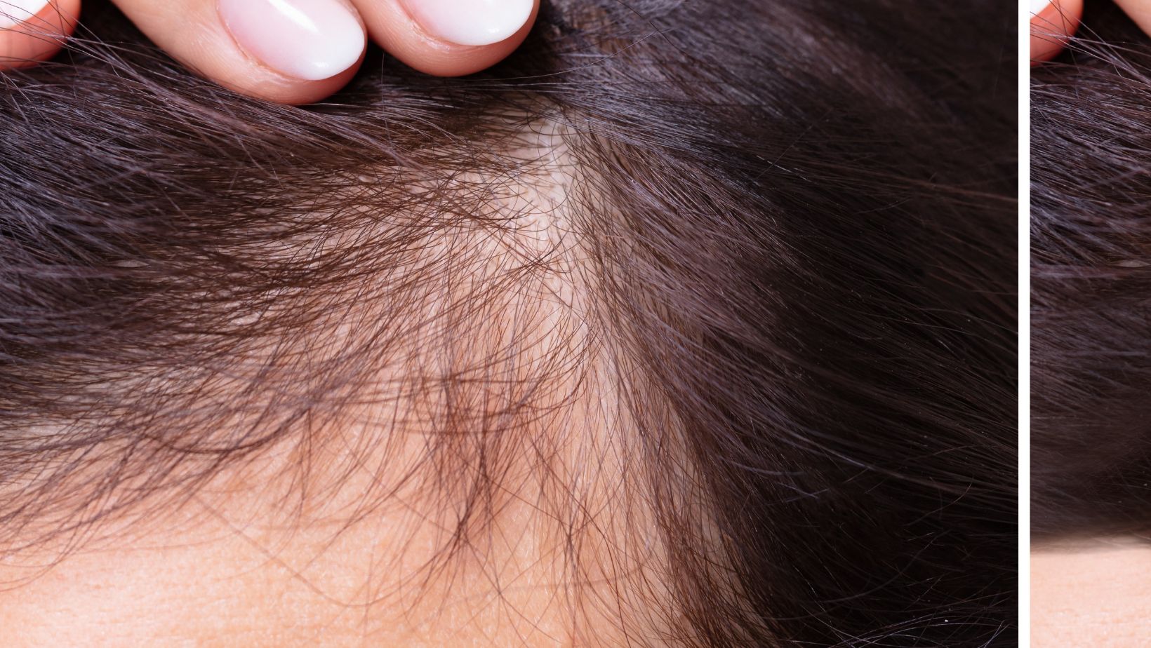 Identity Aesthetics | Aesthetic Treatments Hair Restoration Hair Restoration