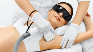 Laser Hair Removal