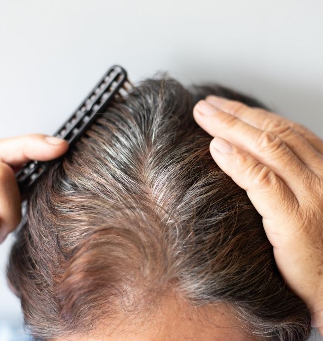 Keralase Hair Restoration