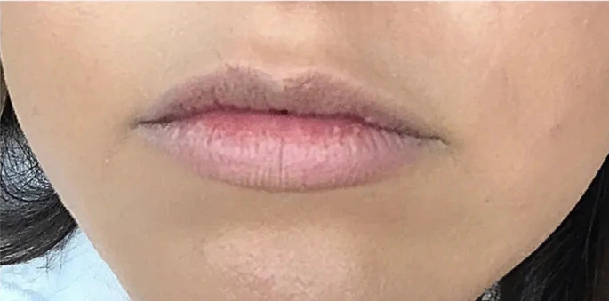 Injectables &Amp; Fillers – Conroe, Tx 8 Identity Aesthetics | Aesthetic Treatments Injectables & Fillers – Conroe, TX injectables Conroe TX