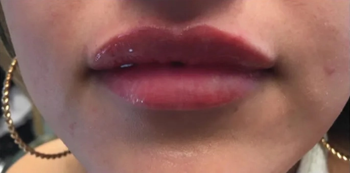 Identity Aesthetics | Aesthetic Treatments Injectables & Fillers – Conroe, TX injectables Conroe TX