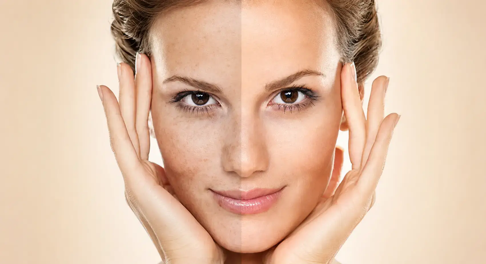 Illustration of visible sun damage and more even-looking skin