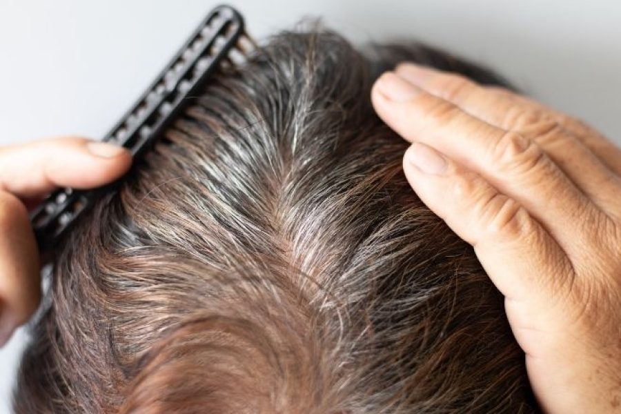 Keralase Hair Restoration
