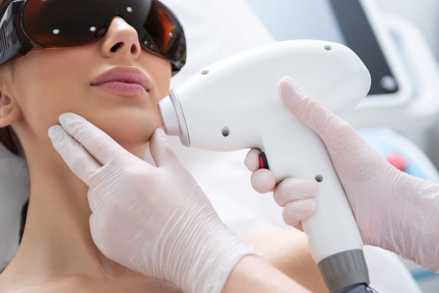 Laser Hair Removal