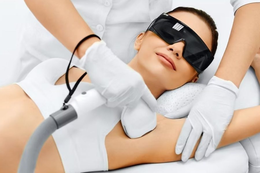 Laser Hair Removal