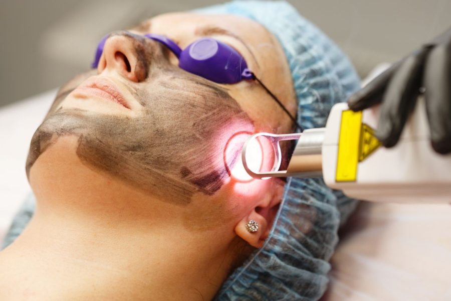 Laser facial rejuvenation is a cutting-edge, non-invasive procedure that utilizes advanced laser technology to revitalize your skin.