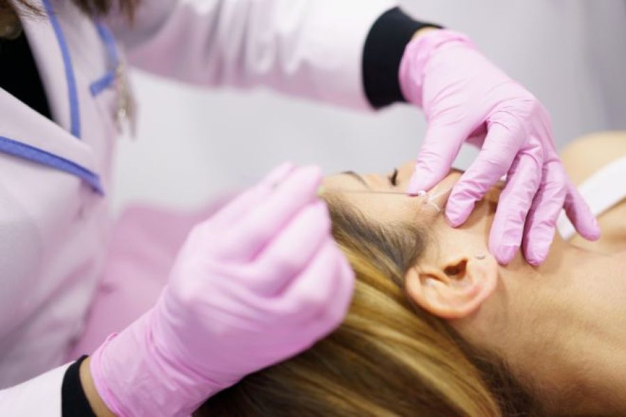 PDO Threads Lift, Tighten, and Rejuvenate Naturally